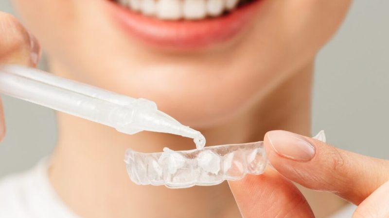 xr:d:DAF5_EEGp5Y:18,j:2476270229667350781,t:24012223